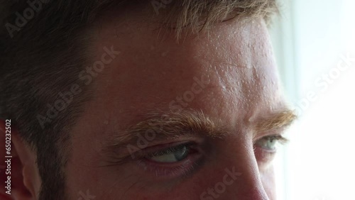 Perspiring guy. This close up macro video shows a nervous man's sweating skin of forehead. 