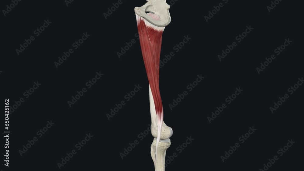 The pectineus muscle is a hip adductor, one of a group of five large