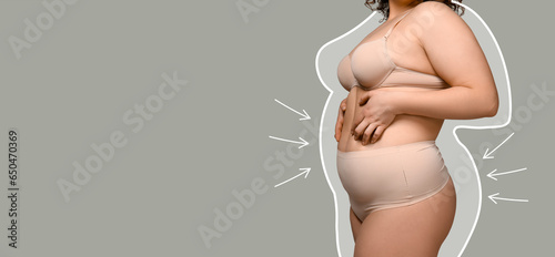 Overweight woman after slim...