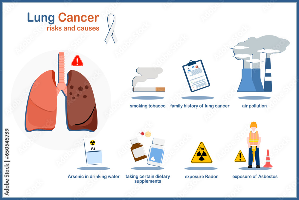 Causes and risk factors that cause lung cancer,medical vector illustrations about causes of lung