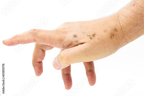 male hand, dry and with skin spots, dermatological problem, solar melanosis starting, skin without sunscreen, isolated on white background, photo
