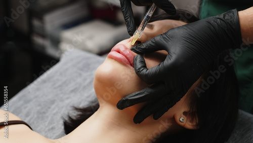 Close-up  woman s lips. A surgeon wearing medical gloves carefully and slowly injects hyaluronic acid into a woman s lips using a syringe. lip augmentation procedure. beauty injections. Plastic surger