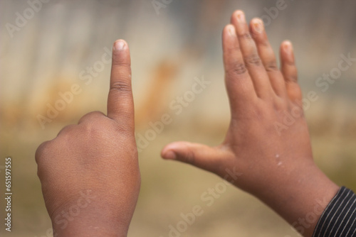 A boy showing six fingers of his hand and and blurred background © Rokonuzzamnan