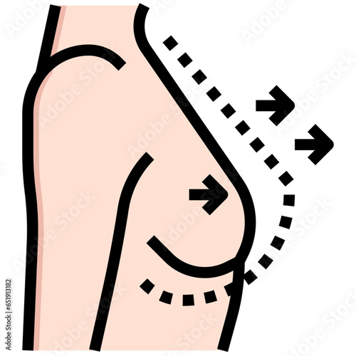 BREAST AUGMENTATION filled outline icon,linear,outline,graphic,illustration