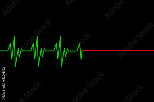 Cardiac cardiogram pulse diagram at death, cardiac arrest on the electrocardiogram monitor