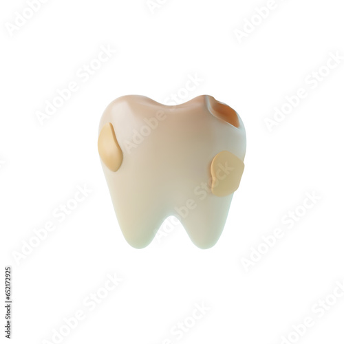 Realistic unhealthy yellow tooth with hole and caries 3D style, vector illustration