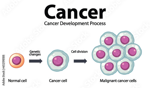 Processing of Cancer Cells: An Infographic Exploration