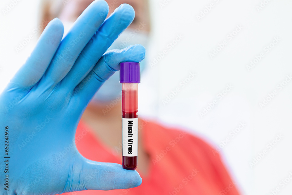 Blood sample tube for Nipah Virus test.Blood sample tube for Nipah virus NiV RT- PCR test.Doctor woman holding a glass test tube. Nipah Henipavirus concept. Blood sample tube for Nipah Virus test.Blood sample tube for Nipah virus NiV RT- PCR test.Doctor woman holding a glass test tube. Nipah Henipavirus concept.