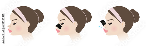 Cute woman with blackhead pore strip on nose side view vector illustration isolated on white background. Direction for use, how to use, step of use blackhead removal nose pore strip.