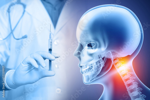 Cervical Epidural Steroid Injection, Neck pain, cervical spine skeleton. 3d illustration photo