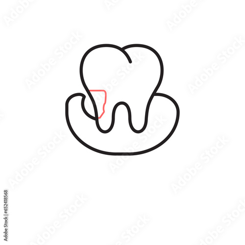 Periodontitis, Gum Disease.