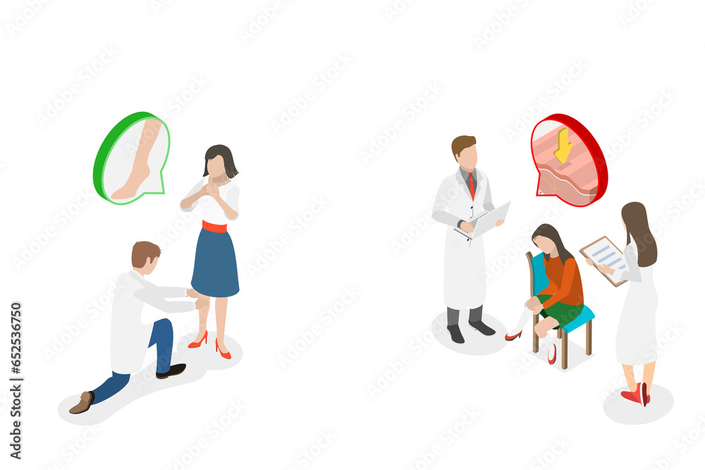 3D Isometric Flat Conceptual Illustration of Edema, Legs Swelling Disease 3D Isometric Flat Conceptual Illustration of Edema, Legs Swelling Disease