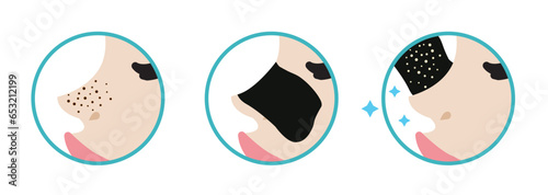 Direction for use blackhead pore strip treatment vector icon set illustration on white background. How to use blackhead removal nose pore strip and reveal beauty skin. Before and after concept.