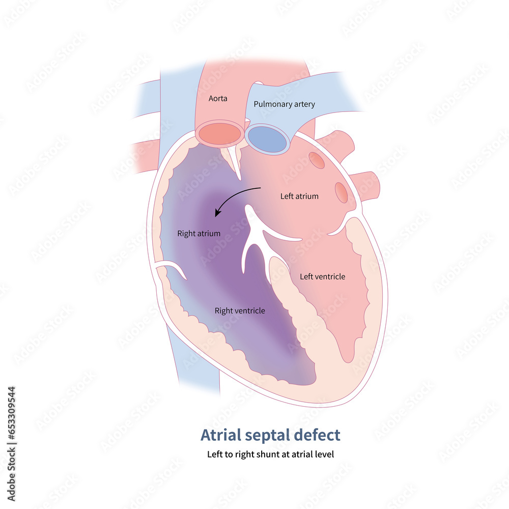 The projection of the plane vectorcardiogram on the frontal plane forms