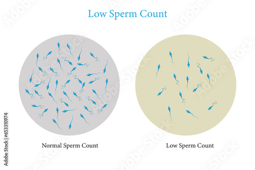 normal and low sperm count illustration. Vector illustration. eps 10