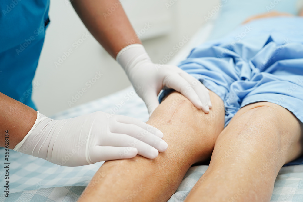 Obraz premium Doctor checking Asian elderly woman patient with scar knee replacement surgery in hospital.
