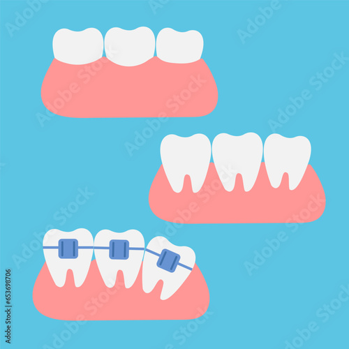 A set of teeth on a blue background. The concept of dental health. Dentistry icons. Vector. Flat style