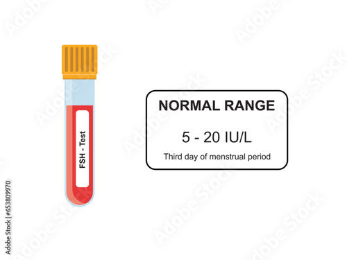 Follicle Stimulating Hormone (FSH) Blood Test Concept Design. Vector Illustration.
