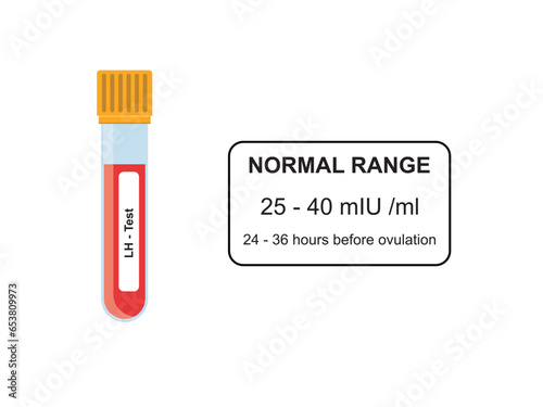 Luteinizing Hormone (LH) Blood Test Concept Design. Vector Illustration.
