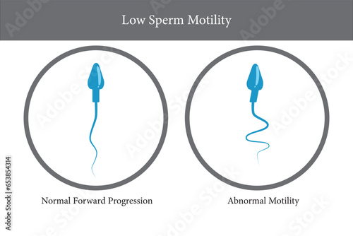 Sperm motility, low sperm count, Semen analysis, vector illustration eps10