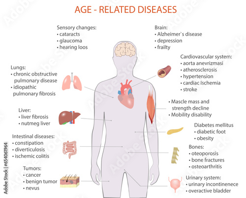 vector illustration of age-related diseases