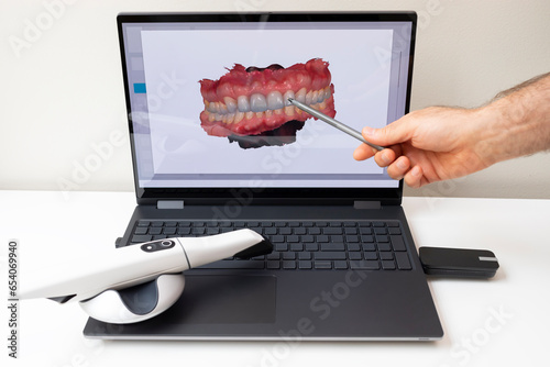 Dentist Shows 3D Scanned Picture of Scanned Teeth on Monitor of Computer. White 3d Intraoral Dental Tooth Scanner Lying on Table. Dental Equipment, Device For Scanning Teeth. Dentistry. Horizontal photo