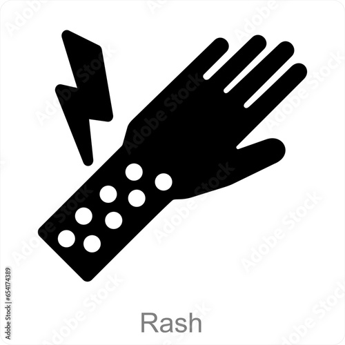 Rash