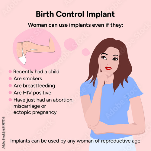 Birth control implant