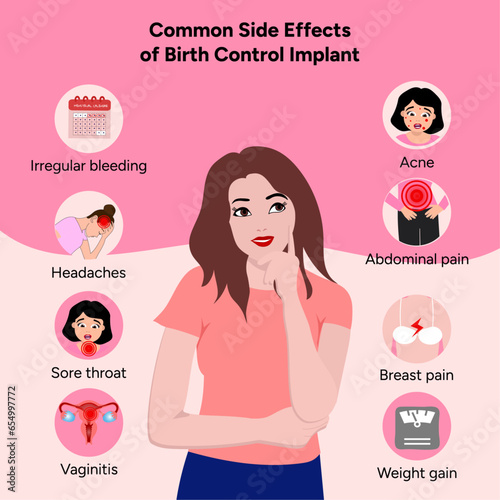 Common side effects of birth control implant