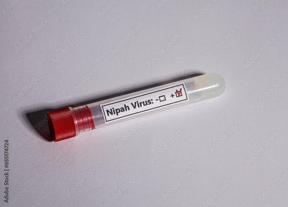 A picture with a white background and a transparent test tube has the Nipah Virus positive on it. A picture with a white background and a transparent test tube has the Nipah Virus positive on it.