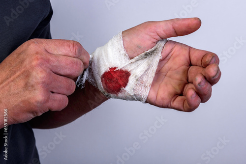 A woman holds a dirty bandaged hand with a bloodstain on a gray background. © Natallia