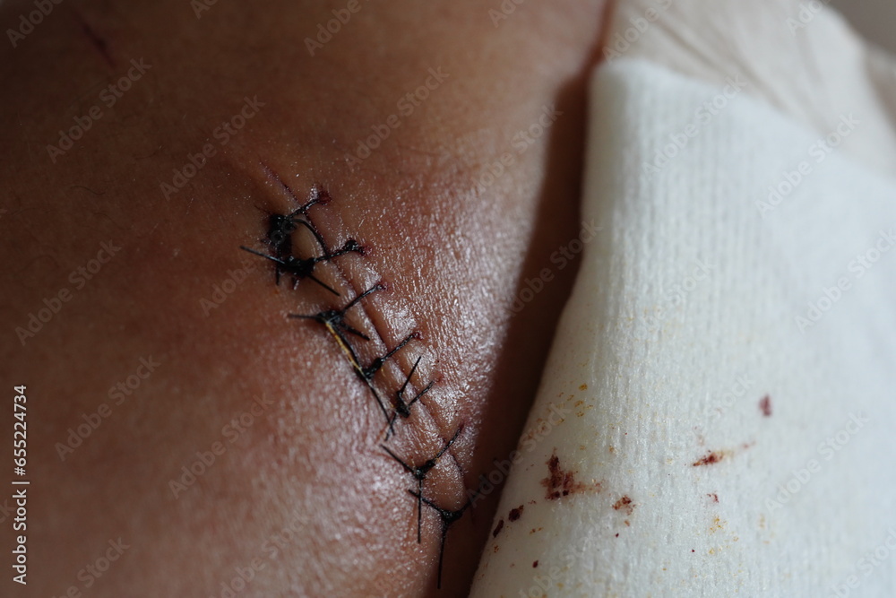 Obraz premium Surgery.