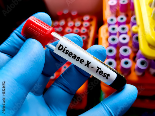 Blood sample for Disease X test. Disease X represents the knowledge that a serious international epidemic could be caused by a pathogen currently unknown to cause human disease