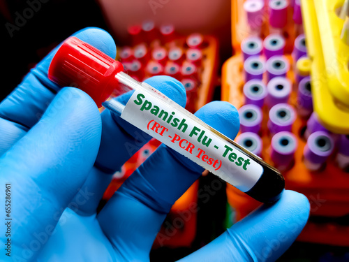 Blood sample for Spanish Flu test.