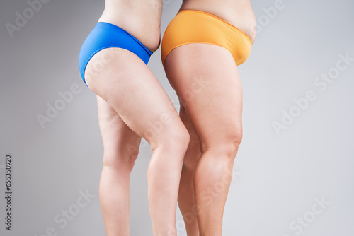 Overweight thighs, two women with fat hips, legs and buttocks, obesity female body with cellulite on gray background