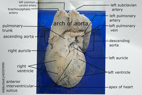 anatomical features of anterior view of human heart with attached great vessels  photo