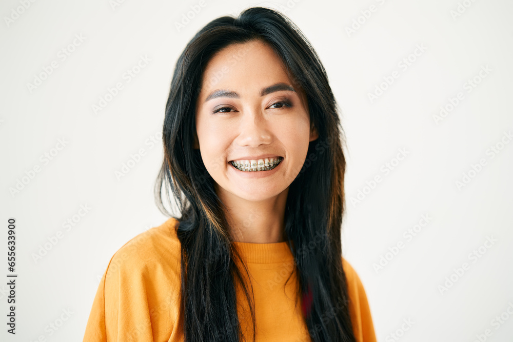 Closeup portrait of young smiling asian woman with braces on white studio background Closeup portrait of young smiling asian woman with braces on white studio background