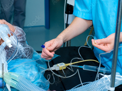 The hands of a doctor in a blue medical suit hold a medical drip for intravenous infusion of drugs. Installing an IV in the operating room.