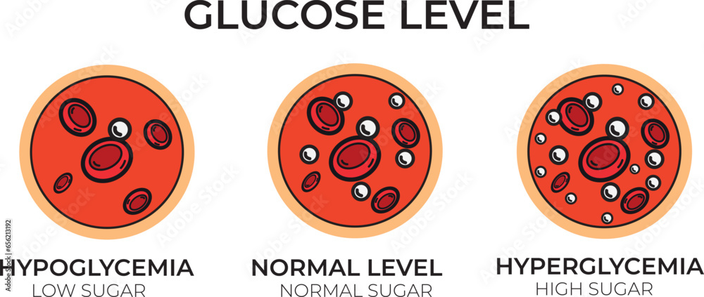 Glucose blood sugar test. Hypoglycemia or hyperglycemia insulin diabetes diagram icon. Glucose blood sugar test. Hypoglycemia or hyperglycemia insulin diabetes diagram icon.