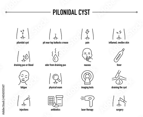 Pilonidal Cyst symptoms, diagnostic and treatment vector icons. Line editable medical icons.