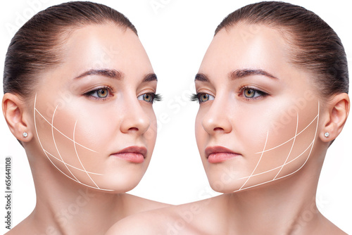 Εκτύπωση καμβά Woman before and after cheekbones shape correction.