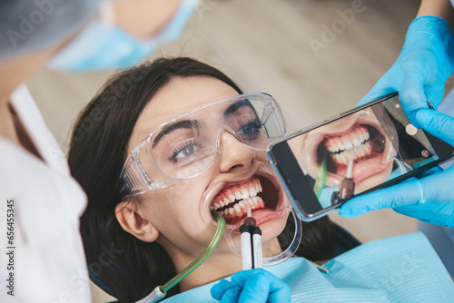 Patient in a dental chair with an open mouth receives treatment from the dentist while an assistant captures the process on a smartphone