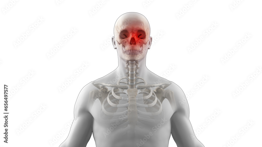 Human skeleton with orbital face fracture - obrazy, fototapety, plakaty 