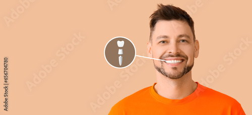 Smiling man with implanted ...