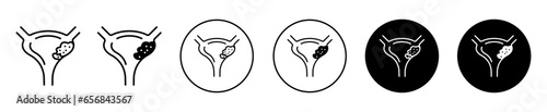 Bladder cancer icon. overactive human bladder causing problem in urinary system symbol set. Urology kidney disease or bladder cancer treatment vector sign. Bladder prostate tumor line logo