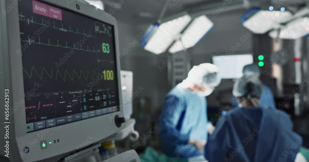 ECG, screen and machine for cardiology in surgery, operation theater or hospital. Heart rate monitor, digital EKG and electrocardiogram of surgeon, people or teamwork in emergency room for healthcare