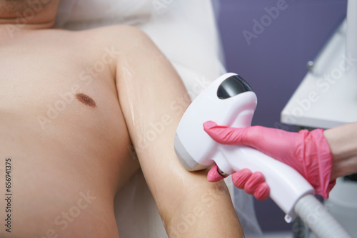 Man getting laser hair removal of arm at clinic photo