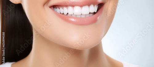 Young female smile after teeth whitening procedure. Dental care. Dentistry concept.