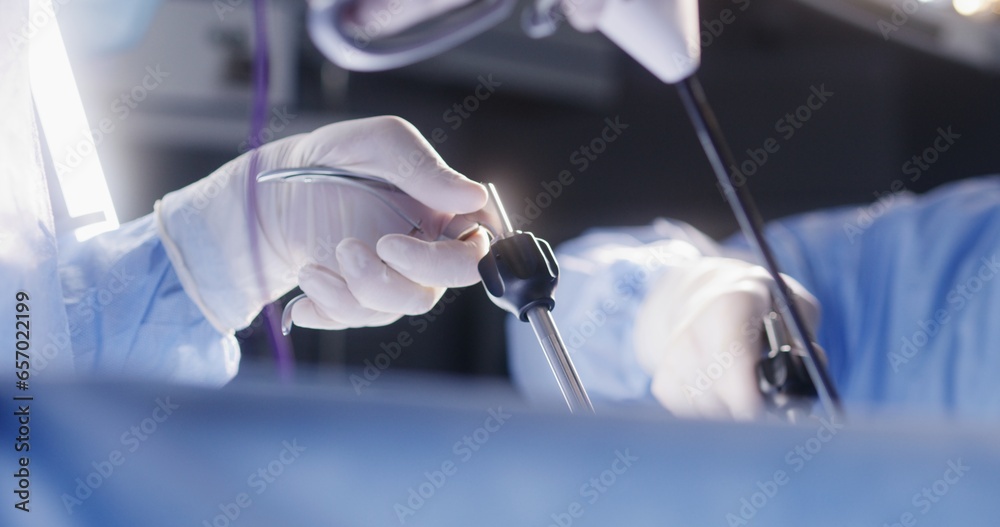 Hands close up of professional surgeons performing operation using laparoscopic tools. Medical staff together save seriously injured patient in surgery room. Medics work in modern medical facility. - obrazy, fototapety, plakaty 