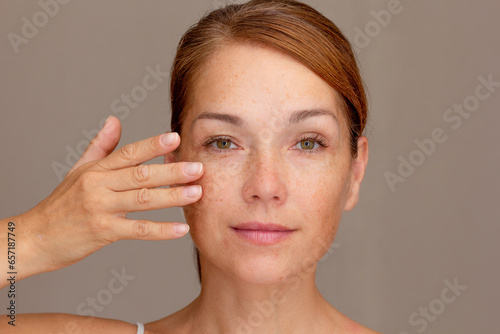Portrait of cropped caucasian middle aged woman face with freckles holding fingers on cheek showing soft skin
